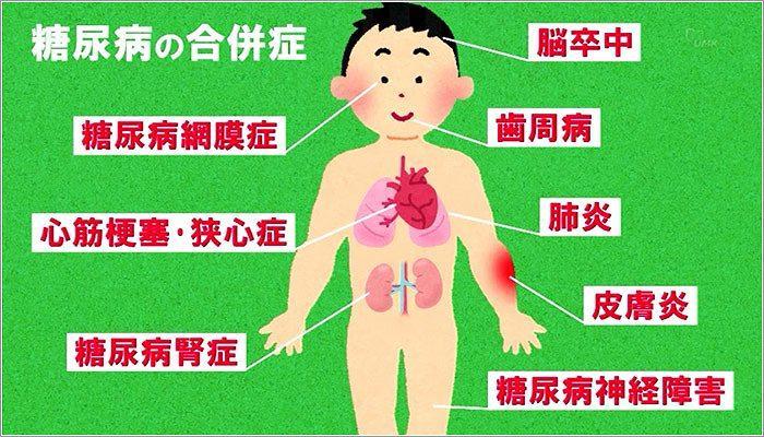 05 糖尿病の合併症