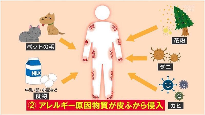 04 アレルギー原因物質