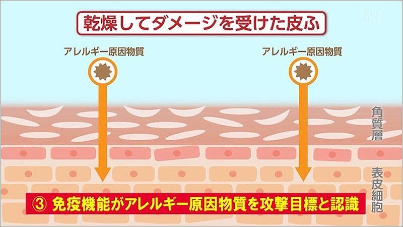 05 免疫機能