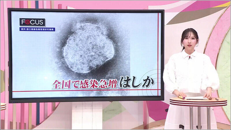 01 はしか