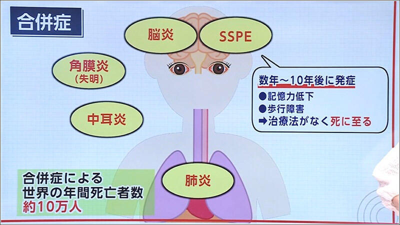 05 合併症