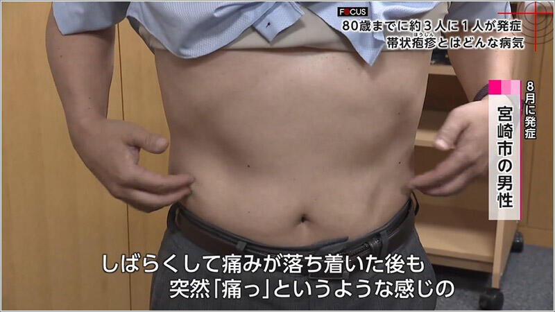 04 8月に発症した男性 2
