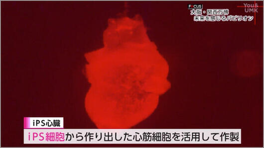 03 iPS細胞