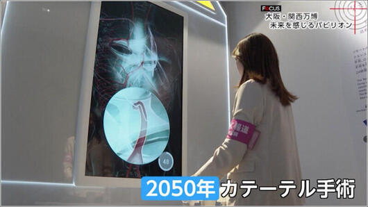 04 2050年のカテーテル手術