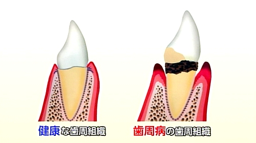 図：歯周組織