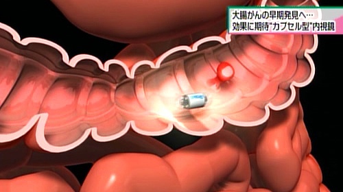 図：撮影イメージ