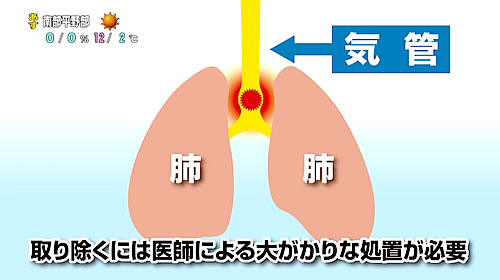 画像：石井先生のコメント