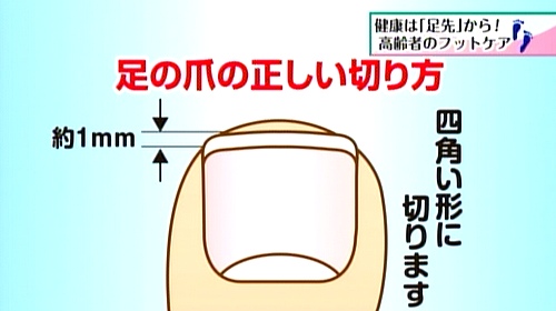 図：足の爪の正しい切り方