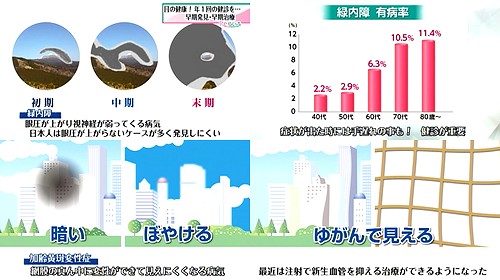 緑内障と加齢黄斑変性症