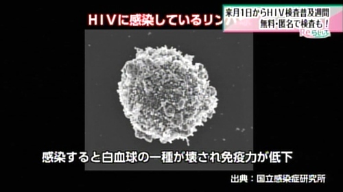 ヒト免疫不全ウイルス
