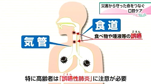 高齢者は注意