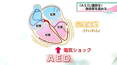 心室細動の図