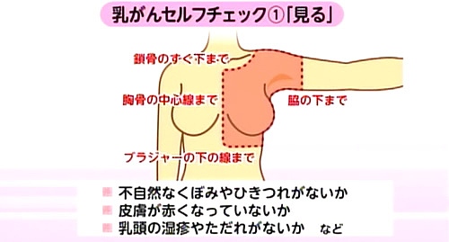 乳がんセルフチェック｛見ること」