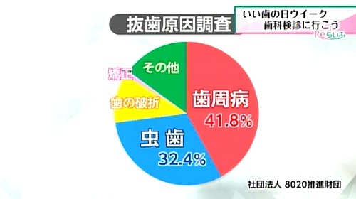 歯を失った原因を調査したグラフ