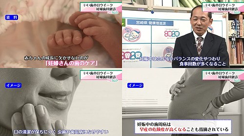 虫歯や歯周病を起こしやすい