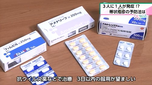 治療には抗ウイルス薬