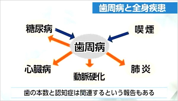 歯周病と全身疾患